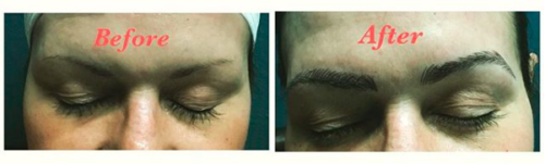 Microblading Before |After