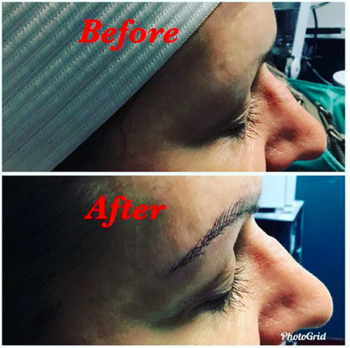 Microblading Before |After