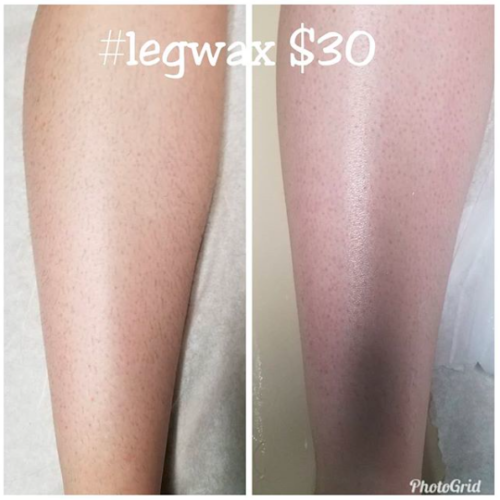 Full Leg Waxing Before|After
