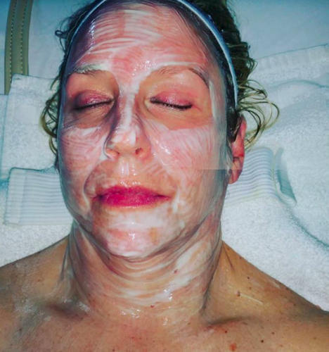 Facial Treatments